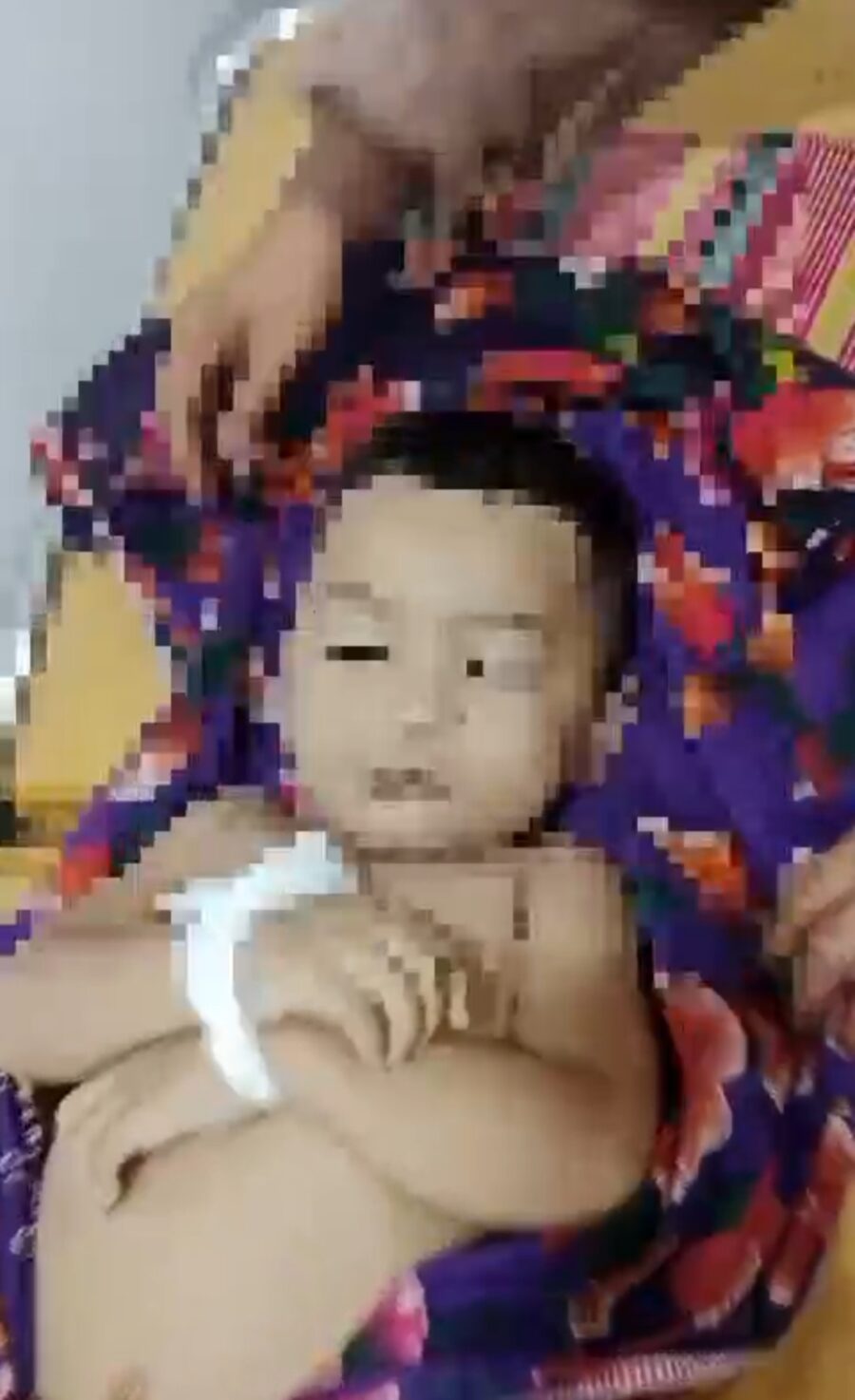 Diduga Malpraktek, Bocah Umur 2 Tahun Setelah Dibius Meninggal Dunia