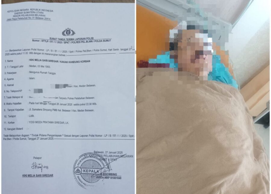 Pulang Kerja Dibacok Orang Tak Kenal, Kakak Korban : Mohon Keadilannya Untuk Adik Saya