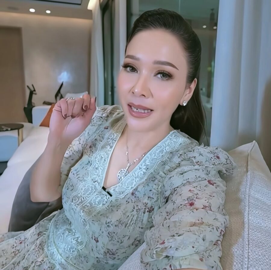 Kenali Penyakit Cacar Api, Ini Kata Maia Estianty