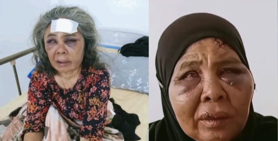 Kejamnya Pekerja Tambang di Pasaman, Seorang Nenek Dilempar Batu Hingga Pingsan